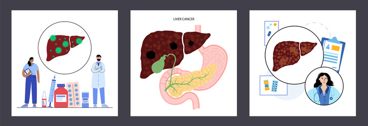 liver disease concept vector