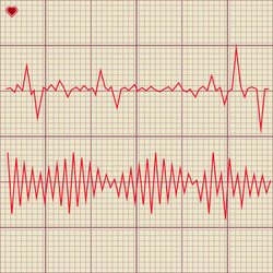 Set of various cardiogram design elements vector