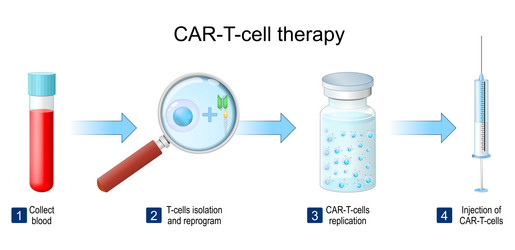 Car T Cell Cancer Therapy Process Of A T Cell Vector Image Car T Cell Cancer Therapy Process Of A T Cell Vector Image