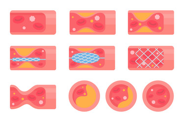 body blood vessels coronary arteries vector