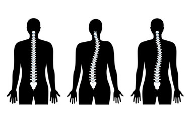 scoliosis flat vector