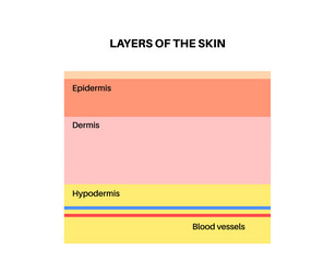 Oily skin cross-section human layers Royalty Free Vector
