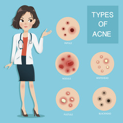 Doctors recommend typ acne vector