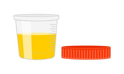 urinalysis urine sample full open plastic vector