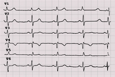 Cardiogram heartbeat the graph on paper vector