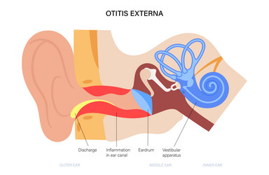 Swimmers ear otitis vector