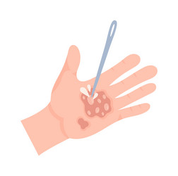 Forbidden skin burn treatment Royalty Free Vector Image