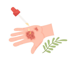 Forbidden skin burn treatment Royalty Free Vector Image