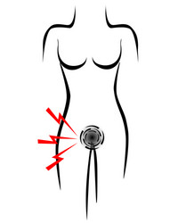 Stylized female body with pain point bladder vector