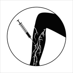 Varicose injection procedure Royalty Free Vector Image