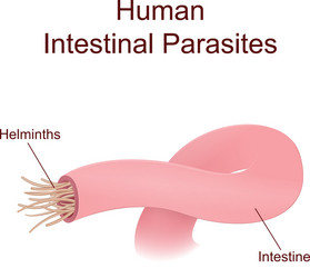 Liver Fluke Vector Images (29)