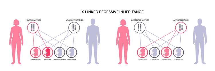 X-Linked Recessive Inheritance vector image