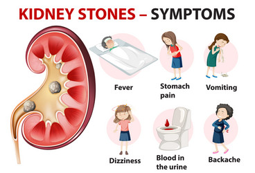 Kidney stones symptoms cartoon style infographic vector