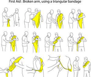 broken arm using a triangular bandage vector