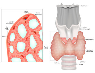 Thyroid gland various diseases goiter Royalty Free Vector