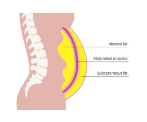 Visceral Fat Vector Images (over 150)