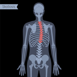 spine x ray vector