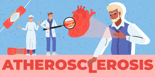 Atherosclerosis Flat Text Composition Royalty Free Vector