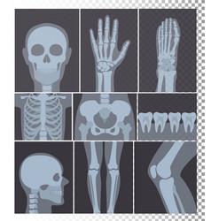 Hand bone anatomy Royalty Free Vector Image - VectorStock