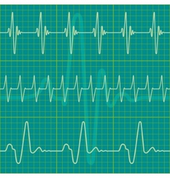 A set of diagrams vector image