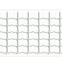 Heart cardiogram eps 8 vector image