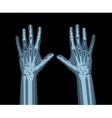 Xray hands vector image