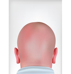 Realistic bald head vector image