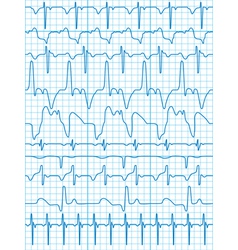 Cardiogram vector image