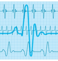 Cardiogram vector image